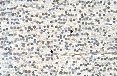 Anti-GAPVD1 antibody, N-term used in IHC (Paraffin sections) (IHC-P). GTX47022