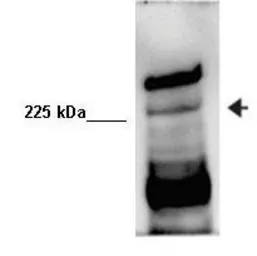 Anti-EXPH5 antibody, Internal used in Western Blot (WB). GTX47026