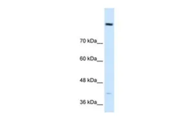 Anti-COBLL1 antibody, N-term used in Western Blot (WB). GTX47028