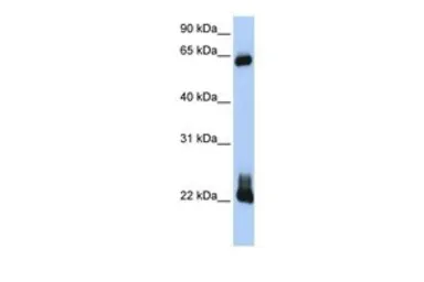 Anti-RHOD antibody, C-term used in Western Blot (WB). GTX47030