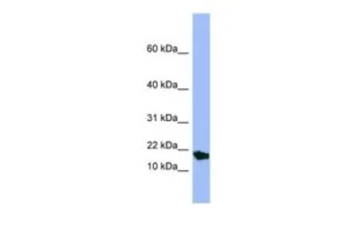 Anti-SMR3A antibody, Internal used in Western Blot (WB). GTX47040