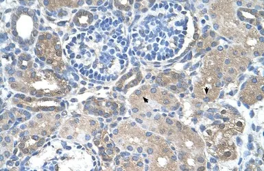 Anti-SARDH antibody, Internal used in IHC (Paraffin sections) (IHC-P). GTX47043