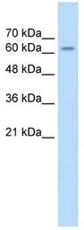 Anti-SARDH antibody, Internal used in Western Blot (WB). GTX47043