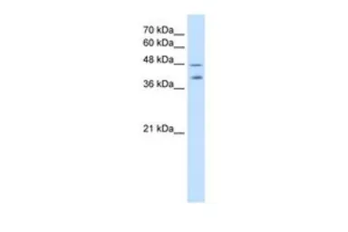 Anti-PSG1 antibody, C-term used in Western Blot (WB). GTX47045