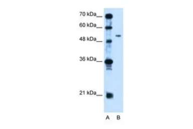 Anti-PSG1 antibody, N-term used in Western Blot (WB). GTX47046
