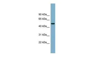 Anti-PRSS16 antibody, Internal used in Western Blot (WB). GTX47053