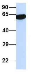 Anti-PRSS16 antibody, Internal used in Western Blot (WB). GTX47053