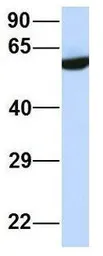 Anti-PRSS16 antibody, Internal used in Western Blot (WB). GTX47053