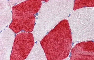Anti-TNNI1 antibody, N-term used in IHC (Paraffin sections) (IHC-P). GTX47077