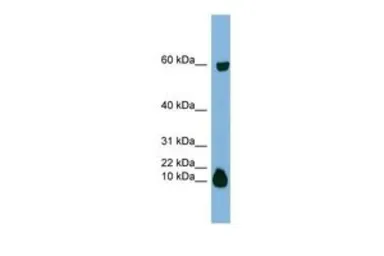 Anti-STATH antibody, Internal used in Western Blot (WB). GTX47081