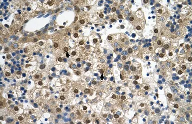 Anti-SQLE antibody, C-term used in IHC (Paraffin sections) (IHC-P). GTX47082