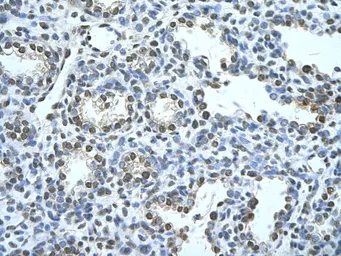 Anti-SQLE antibody, C-term used in IHC (Paraffin sections) (IHC-P). GTX47082