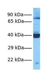 Anti-SQLE antibody, C-term used in Western Blot (WB). GTX47082