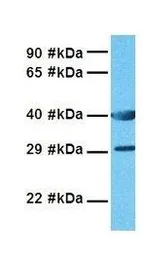 Anti-NTCP antibody, Internal used in Western Blot (WB). GTX47083