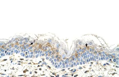Anti-S100A3 antibody, N-term used in IHC (Paraffin sections) (IHC-P). GTX47086