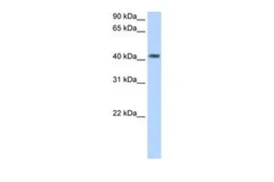 Anti-PSG5 antibody, N-term used in Western Blot (WB). GTX47088