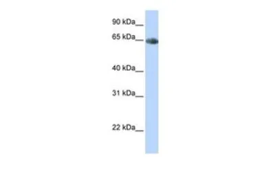 Anti-SLC6A2 antibody, Internal used in Western Blot (WB). GTX47102