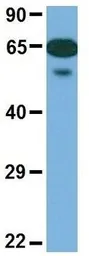 Anti-SLC6A2 antibody, Internal used in Western Blot (WB). GTX47102