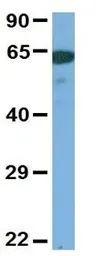 Anti-SLC6A2 antibody, Internal used in Western Blot (WB). GTX47102
