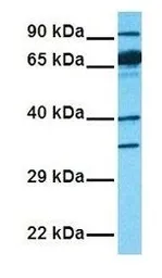 Anti-SLC6A2 antibody, Internal used in Western Blot (WB). GTX47102