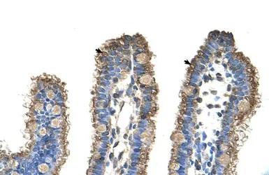 Anti-RHOBTB1 antibody, Internal used in IHC (Paraffin sections) (IHC-P). GTX47103