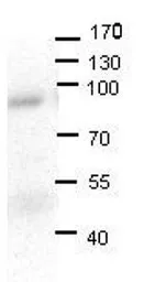 Anti-LSS antibody, N-term used in Western Blot (WB). GTX47109