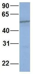Anti-CYP2C19 antibody, Internal used in Western Blot (WB). GTX47113