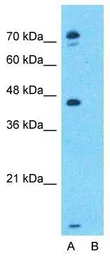 Anti-EPX antibody, Internal used in Western Blot (WB). GTX47120