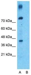 Anti-ABCB4 antibody, N-term used in Western Blot (WB). GTX47123