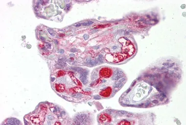 Anti-SLC26A4 antibody, Internal used in IHC (Paraffin sections) (IHC-P). GTX47124