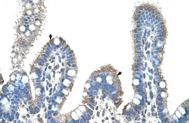 Anti-SLC22A1 antibody, C-term used in IHC (Paraffin sections) (IHC-P). GTX47131