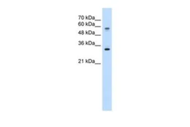Anti-SLC22A1 antibody, C-term used in Western Blot (WB). GTX47131