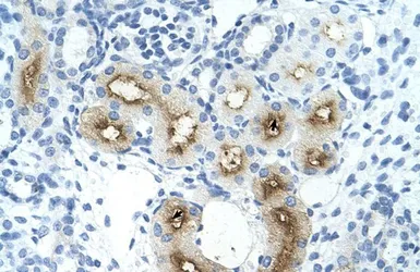 Anti-GGTLA4 antibody, C-term used in IHC (Paraffin sections) (IHC-P). GTX47132