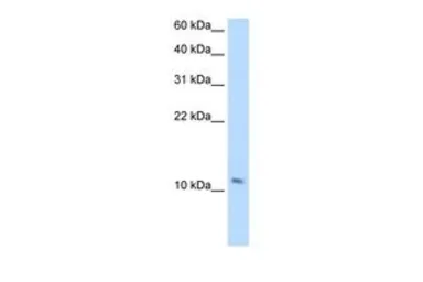 Anti-SMPX antibody, Internal used in Western Blot (WB). GTX47137