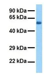 Anti-HMGCS2 antibody, N-term used in Western Blot (WB). GTX47146