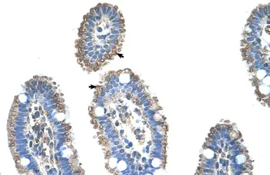 Anti-SLC22A1 antibody, N-term used in IHC (Paraffin sections) (IHC-P). GTX47150