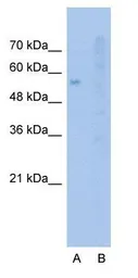 Anti-SLC22A1 antibody, N-term used in Western Blot (WB). GTX47150