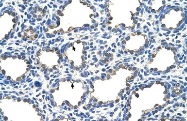 Anti-EMP2 antibody, Internal used in IHC (Paraffin sections) (IHC-P). GTX47154