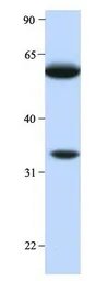 Anti-HRG antibody, Internal used in Western Blot (WB). GTX47164
