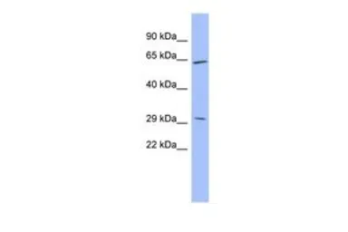 Anti-HRG antibody, Internal used in Western Blot (WB). GTX47165