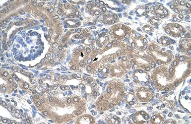 Anti-NKCC2 antibody, N-term used in IHC (Paraffin sections) (IHC-P). GTX47166