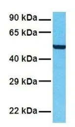 Anti-NKCC2 antibody, N-term used in Western Blot (WB). GTX47166