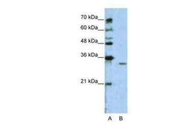 Anti-GNB1L antibody, C-term used in Western Blot (WB). GTX47168