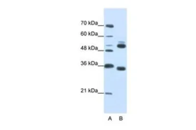 Anti-WDR6 antibody, C-term used in Western Blot (WB). GTX47169