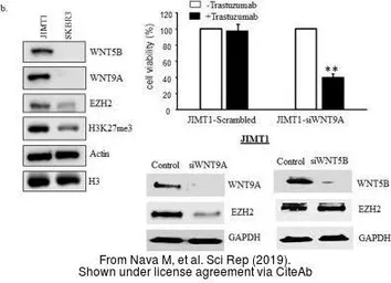 Anti-Wnt5b antibody, C-term used in Western Blot (WB). GTX47174