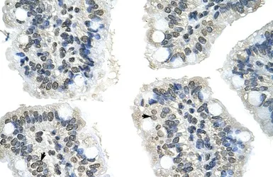 Anti-GIPC2 antibody, N-term used in IHC (Paraffin sections) (IHC-P). GTX47176