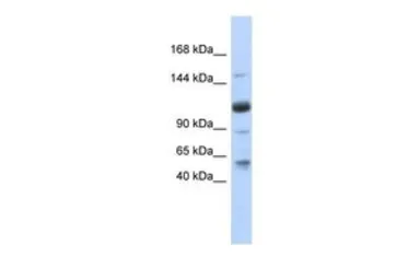 Anti-SR140 antibody, N-term used in Western Blot (WB). GTX47178