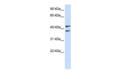 Anti-ZRANB2 antibody, Internal used in Western Blot (WB). GTX47181