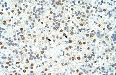 Anti-HNRPA3 antibody, N-term used in IHC (Paraffin sections) (IHC-P). GTX47186