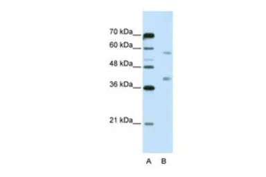Anti-HNRPA3 antibody, N-term used in Western Blot (WB). GTX47186